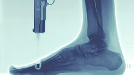 Shot in the foot